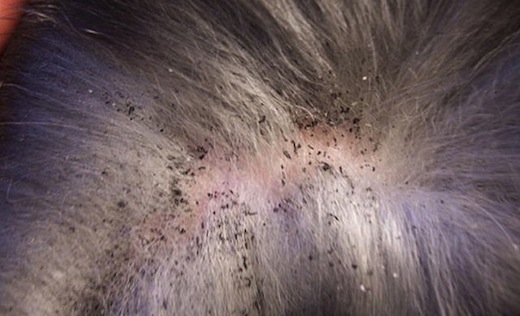 Блохи у собак Фото