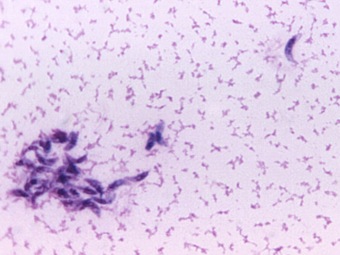 Токсоплазмоз у собак Фото