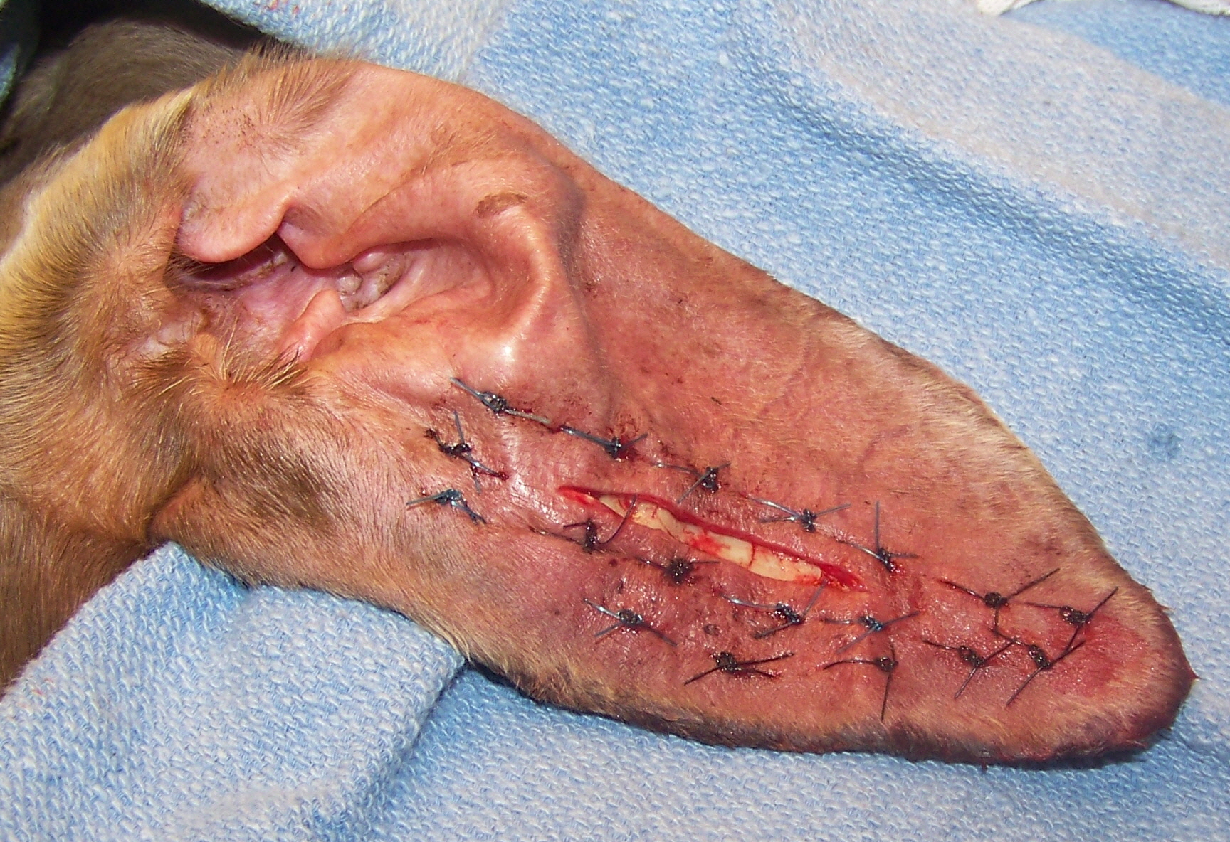 После операции по коррекции отогематомы Фото