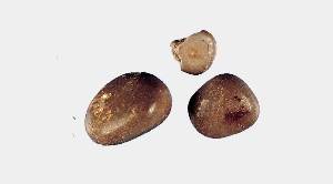 Кристаллы уратов
Фото