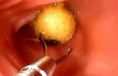 Инородное тело в желудке у собак Фото