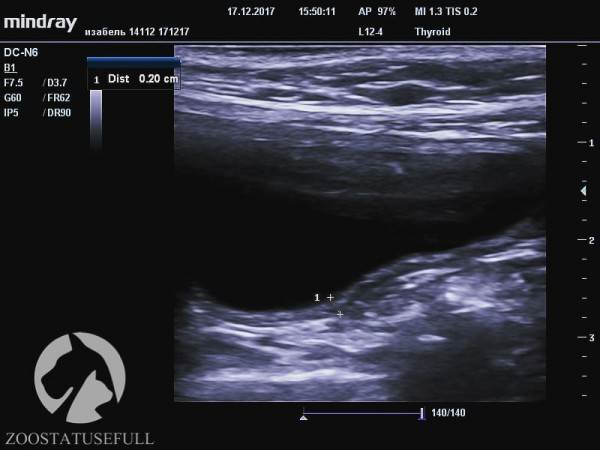 мифы об отжимании спинальников