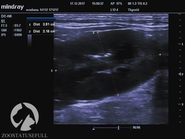 мифы об отжимании спинальников