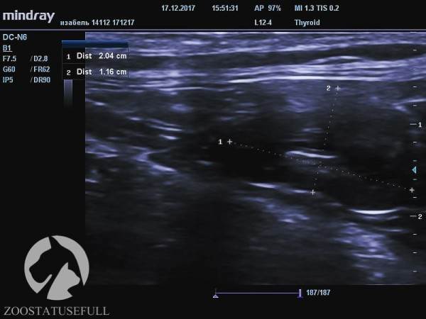 мифы об отжимании спинальников