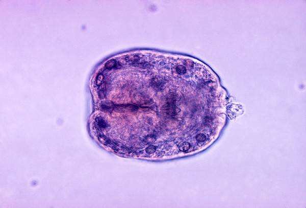 альвеококкоз